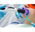 Dentalwise-service-2