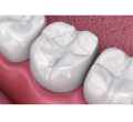 Dentalwise-service-5